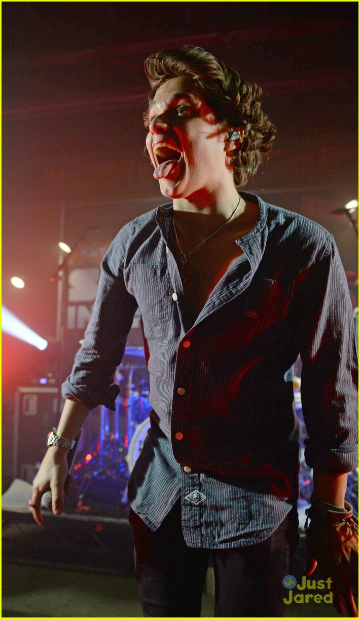 The Vamps Play Secret Gig While Connor Ball Had First Physical Therapy Session After Knee Surgery