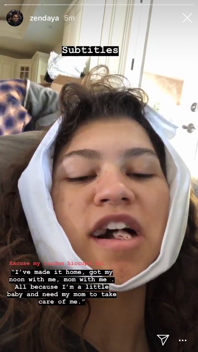 Zendaya Updates Fans With Funny Videos After Getting Her Wisdom Teeth Out
