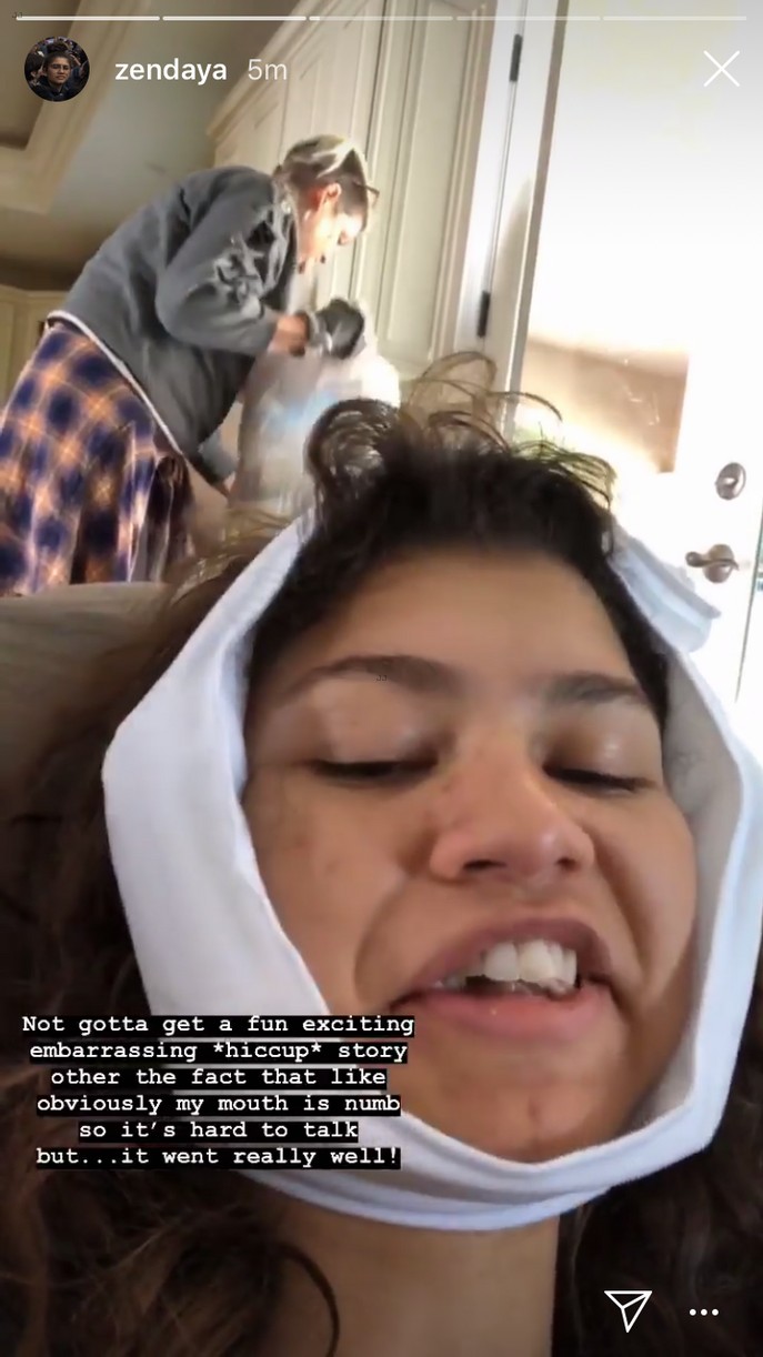 Zendaya Updates Fans With Funny Videos After Getting Her Wisdom Teeth Out