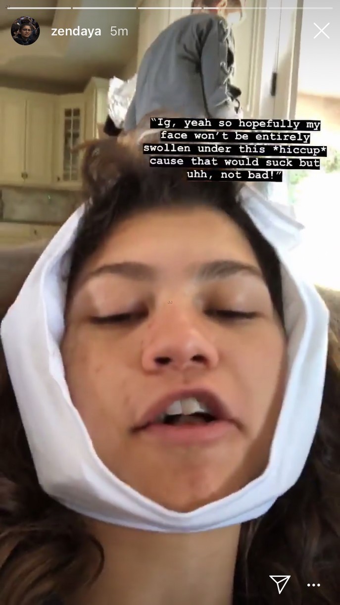 Zendaya Updates Fans With Funny Videos After Getting Her Wisdom Teeth Out